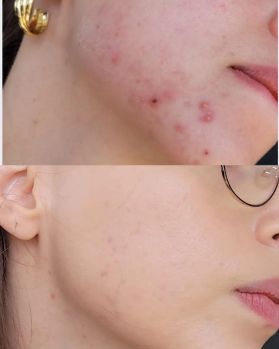 Resultado antes e depois de paciente acompanhada