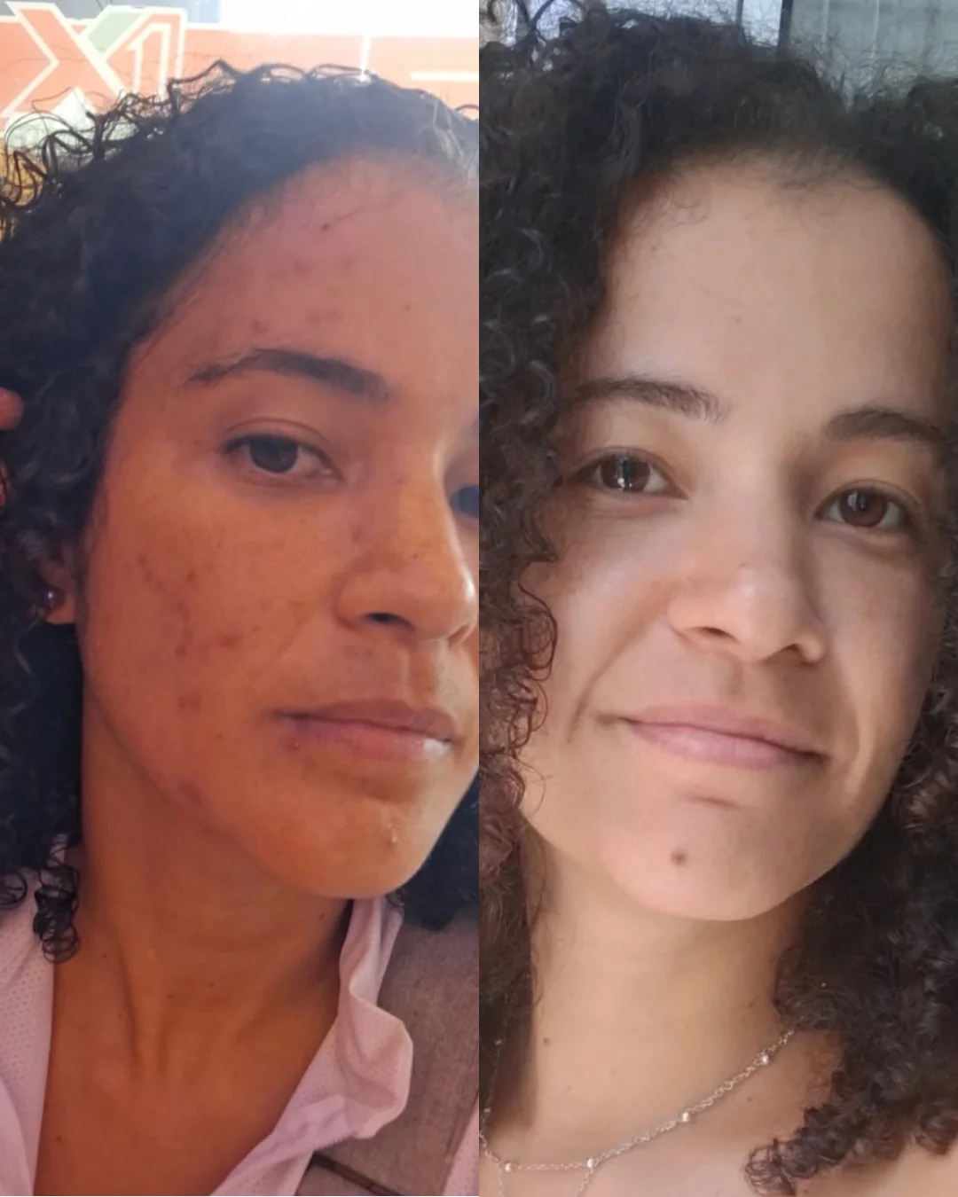 Evolução real de paciente acompanhada
